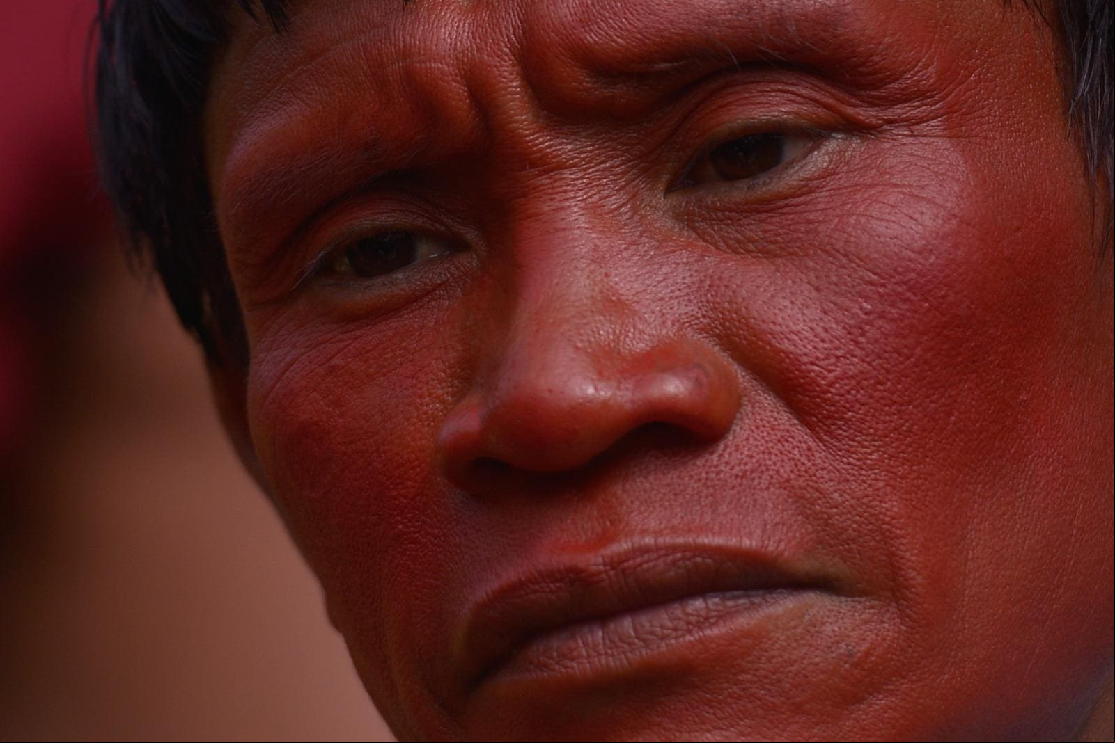 Dor Yanomami Dor, fome, abandono e devastação: reportagem especial de O TEMPO mostra crise dos Yanomami - Foto: Fred Magno/O Tempo